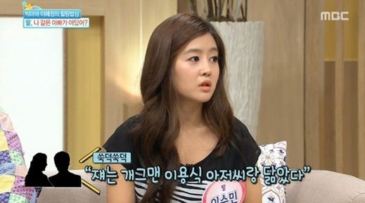 개그맨이용식 눈실명
