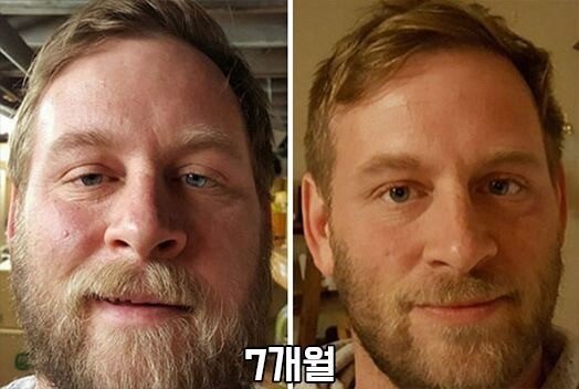 술끊으면생기는변화
